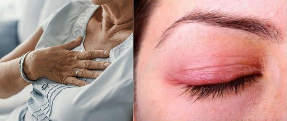 formaldehyde gây hại sức khỏe